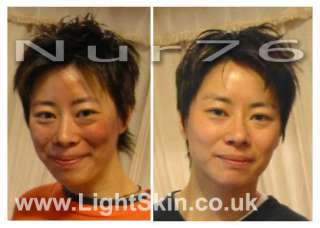 Nur76 Body Lotion 125ml   Skin Lightening  