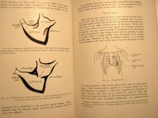   Medical illustrated Book Nearly 100 years old Physical Diagnosis