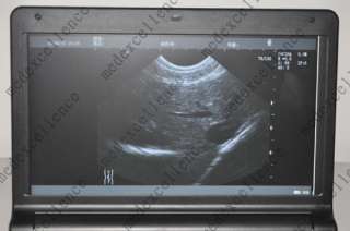   Laptop Veterinary vet Ultrasound Scanner Rectal Probe RUS 9000V  