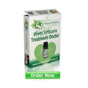 Hives Urticaria Doctor