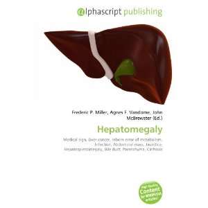  Hepatomegaly (9786134151528) Books