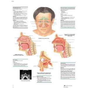   Sinusitis Anatomical Chart (Rhinitis and Sinusitis Anatomical Chart